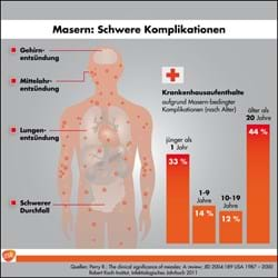 Masern Komplikationen