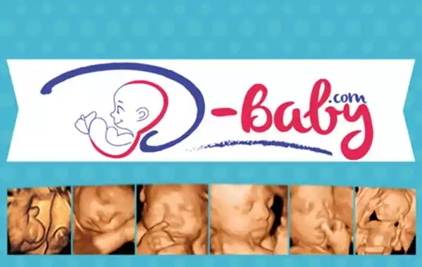 3d Baby Babyviewing