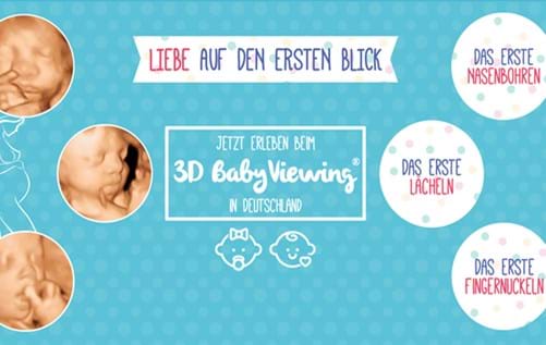 3D Baby Viewing
