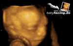 babyfacing.de – 3D/4D Ultraschallstudio