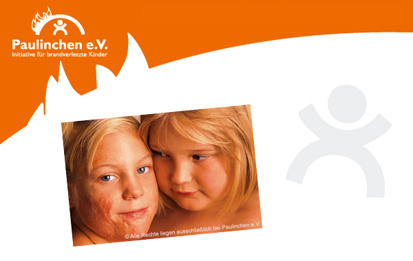 Schützen Sie Ihr Kind vor Verbrennungen und Verbrühungen